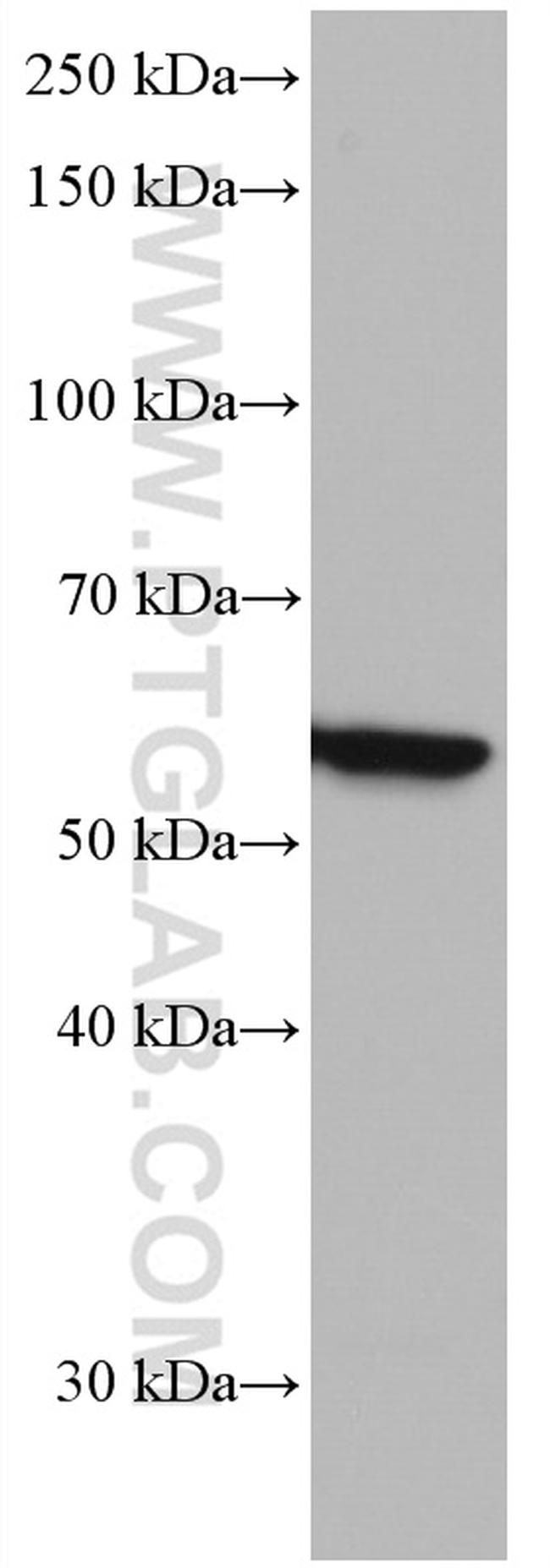 IRF5 Antibody in Western Blot (WB)