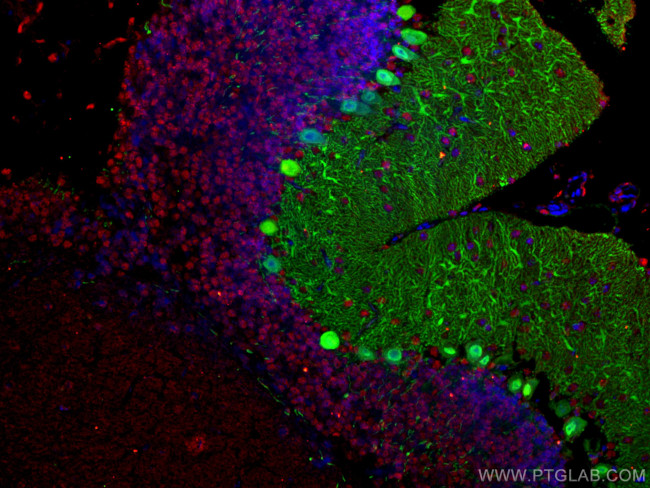 NeuN Antibody in Immunohistochemistry (Paraffin) (IHC (P))