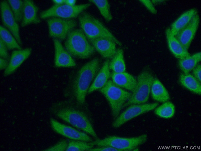 MBNL1 Antibody in Immunocytochemistry (ICC/IF)