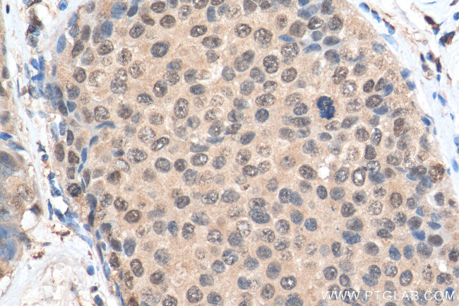 MBNL1 Antibody in Immunohistochemistry (Paraffin) (IHC (P))