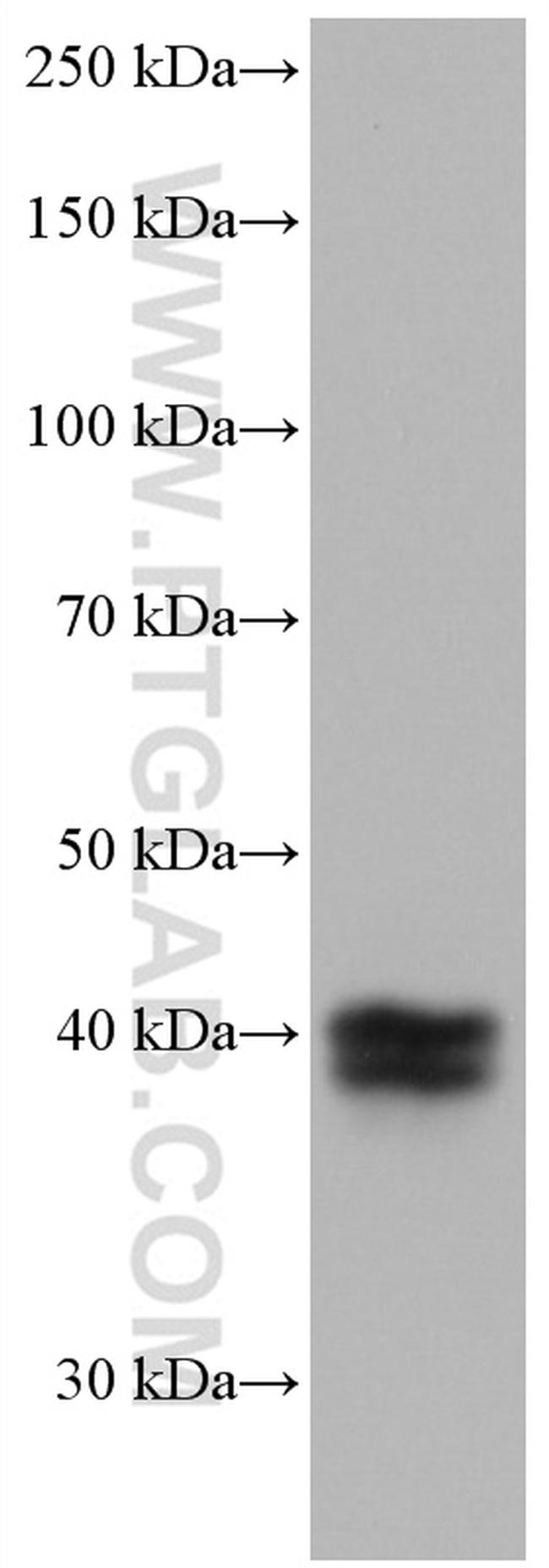 TFPI Antibody in Western Blot (WB)