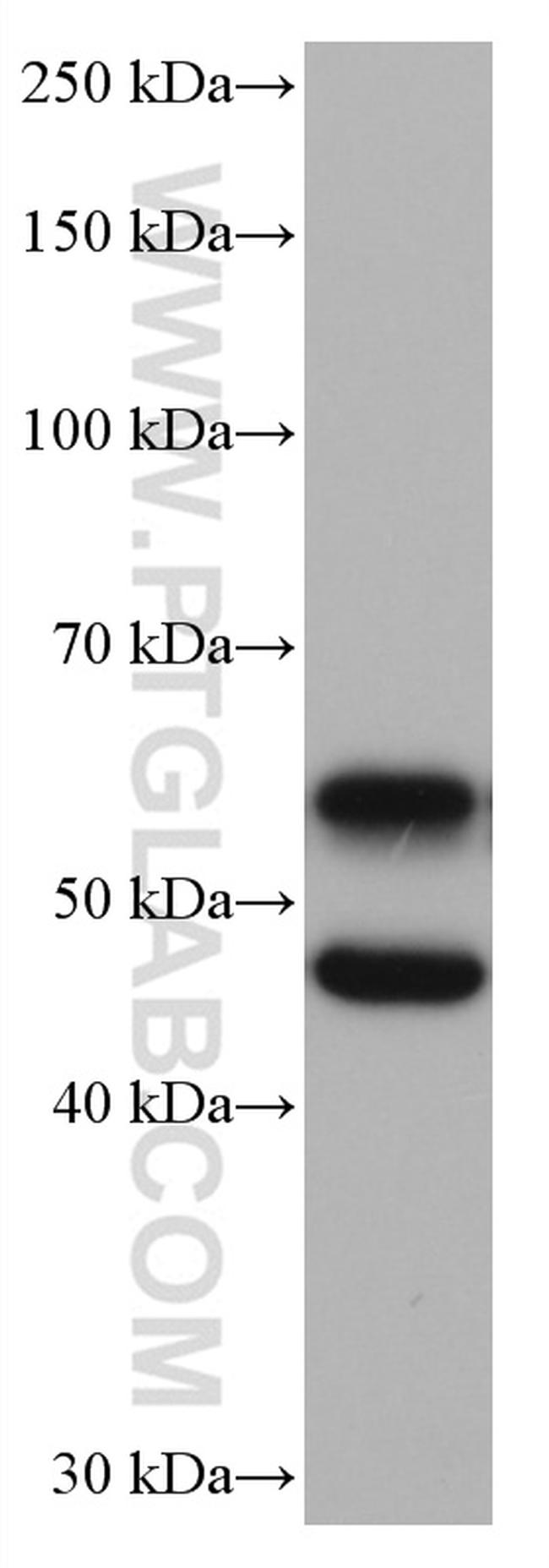 CAMK2 Antibody in Western Blot (WB)