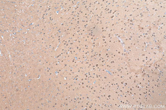 CAMK2 Antibody in Immunohistochemistry (Paraffin) (IHC (P))