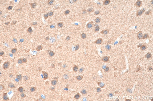 CAMK2 Antibody in Immunohistochemistry (Paraffin) (IHC (P))