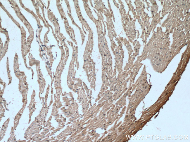 GLUT4 Antibody in Immunohistochemistry (Paraffin) (IHC (P))