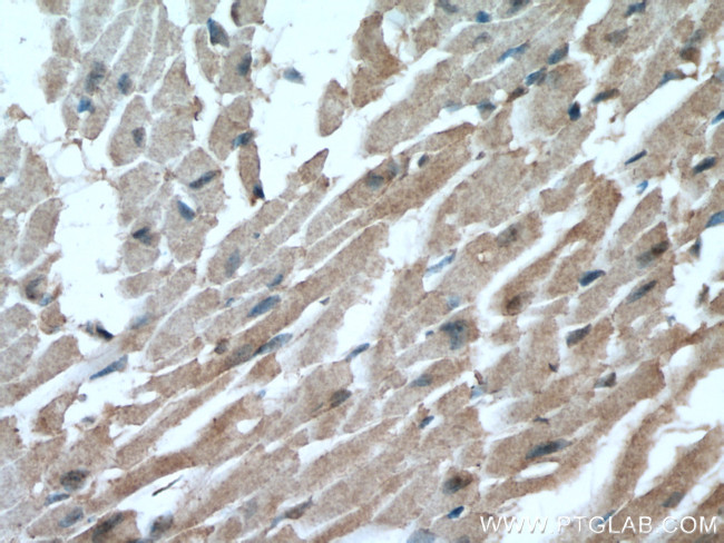 GLUT4 Antibody in Immunohistochemistry (Paraffin) (IHC (P))