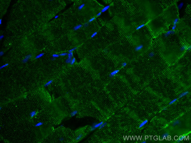 GLUT4 Antibody in Immunohistochemistry (PFA fixed) (IHC (PFA))