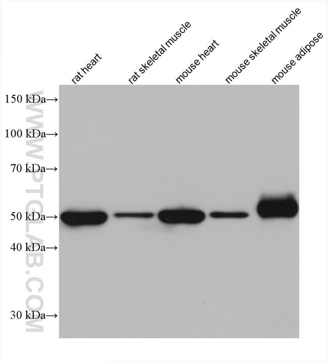 GLUT4 Antibody in Western Blot (WB)