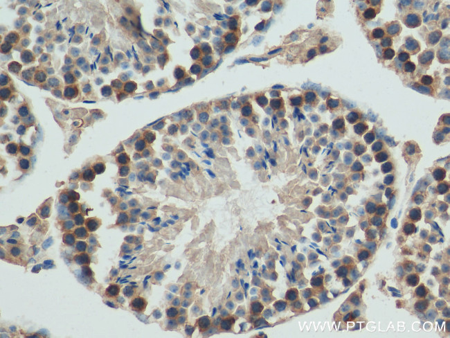 JTV1 Antibody in Immunohistochemistry (Paraffin) (IHC (P))