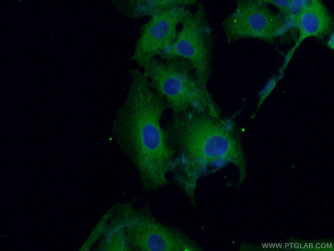 CPLX2 Antibody in Immunocytochemistry (ICC/IF)