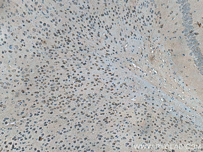 CPLX2 Antibody in Immunohistochemistry (Paraffin) (IHC (P))