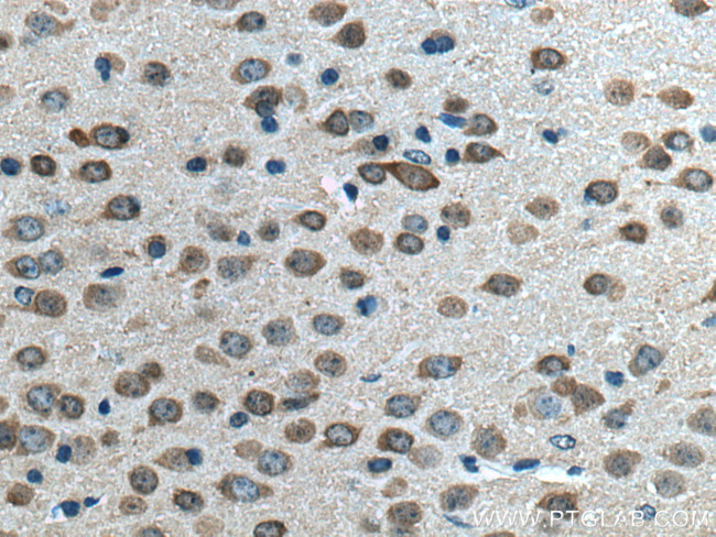 CPLX2 Antibody in Immunohistochemistry (Paraffin) (IHC (P))