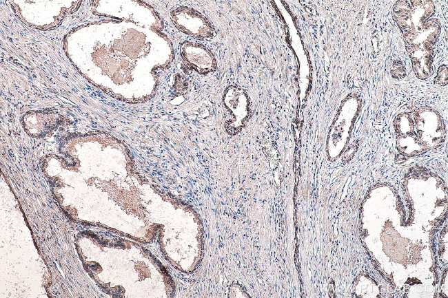 SMO Antibody in Immunohistochemistry (Paraffin) (IHC (P))