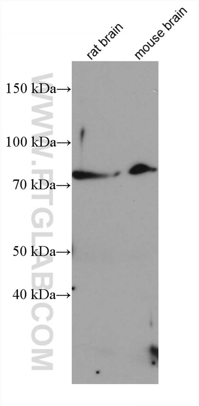 SMO Antibody in Western Blot (WB)