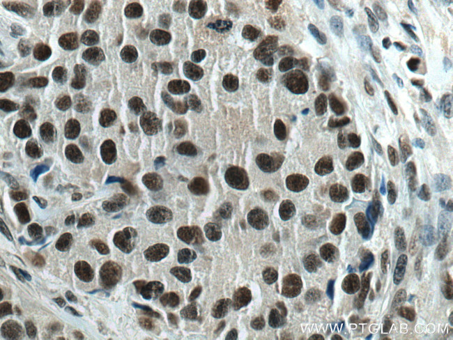 XRN2 Antibody in Immunohistochemistry (Paraffin) (IHC (P))