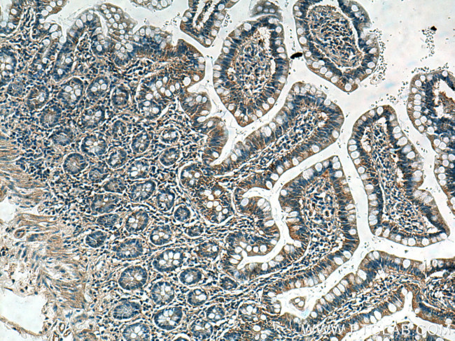 Phospho-RIPK1 (Ser161) Antibody in Immunohistochemistry (Paraffin) (IHC (P))