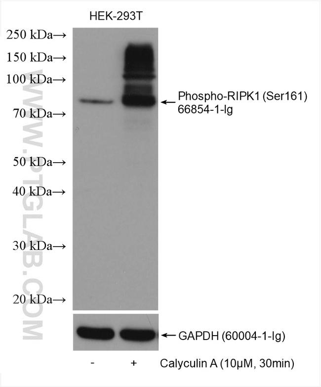 Phospho-RIPK1 (Ser161) Antibody in Western Blot (WB)