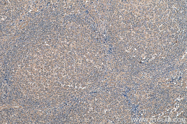 ACVRL1 Antibody in Immunohistochemistry (Paraffin) (IHC (P))