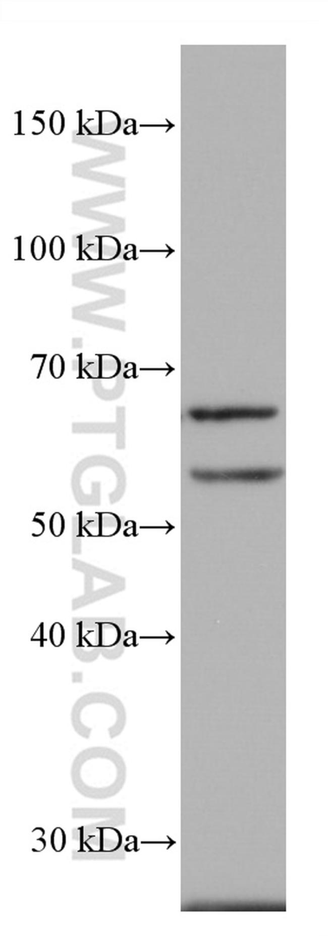 ACVRL1 Antibody in Western Blot (WB)