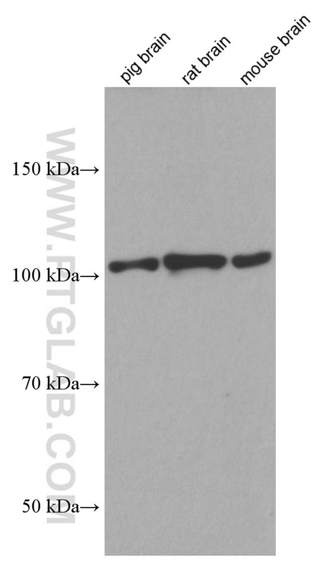 CYLD Antibody in Western Blot (WB)