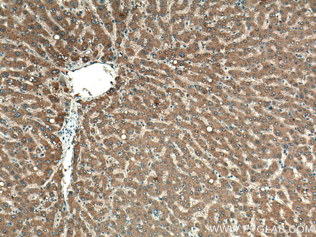 G6PC Antibody in Immunohistochemistry (Paraffin) (IHC (P))