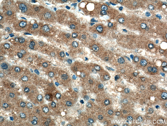 G6PC Antibody in Immunohistochemistry (Paraffin) (IHC (P))