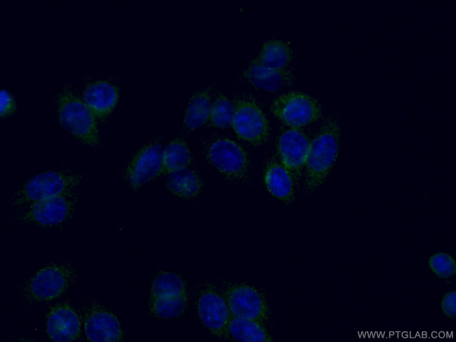 PCK1 Antibody in Immunocytochemistry (ICC/IF)