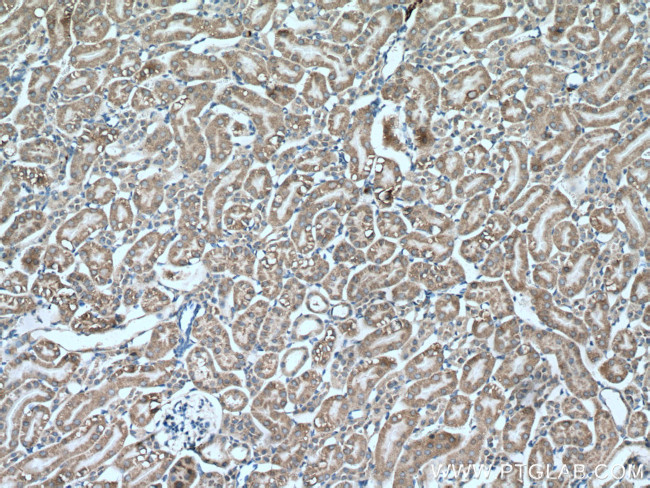 PCK1 Antibody in Immunohistochemistry (Paraffin) (IHC (P))