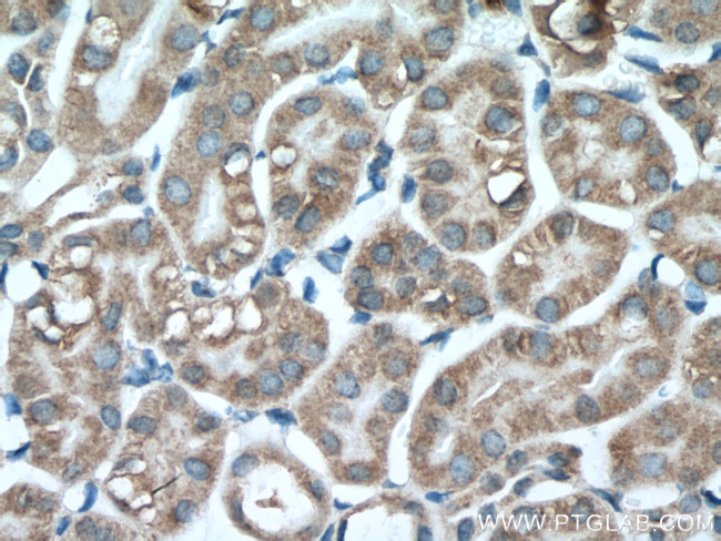 PCK1 Antibody in Immunohistochemistry (Paraffin) (IHC (P))