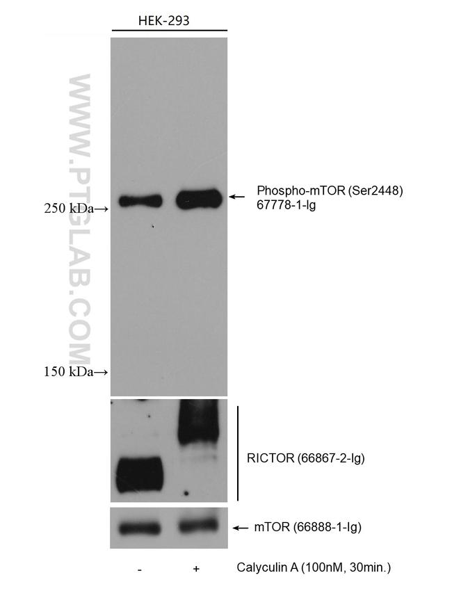 RICTOR Antibody in Western Blot (WB)