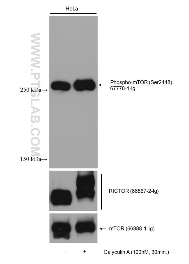 RICTOR Antibody in Western Blot (WB)