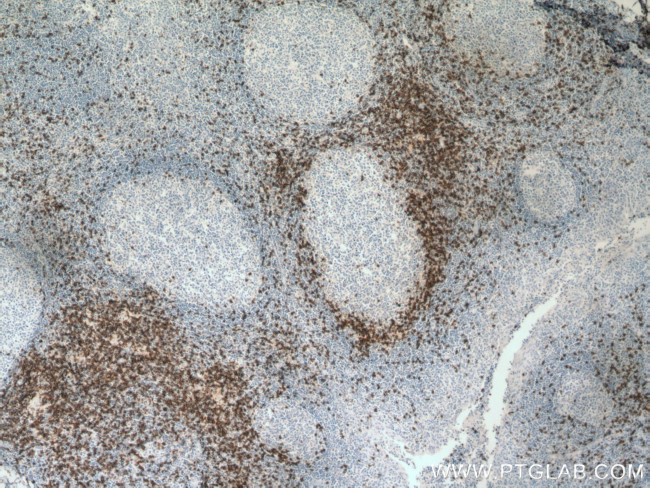CD8 Antibody in Immunohistochemistry (Paraffin) (IHC (P))