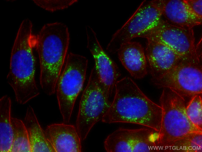 SREBF1 Antibody in Immunocytochemistry (ICC/IF)