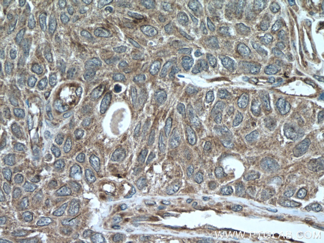 SREBF1 Antibody in Immunohistochemistry (Paraffin) (IHC (P))