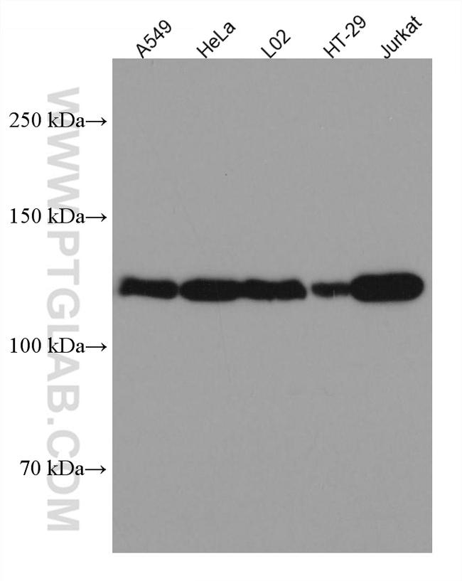 SREBF1 Antibody in Western Blot (WB)