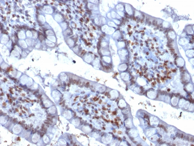 PU.1 (SPI-1) Antibody in Immunohistochemistry (Paraffin) (IHC (P))