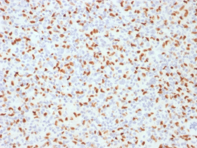 PU.1 (SPI-1) Antibody in Immunohistochemistry (Paraffin) (IHC (P))