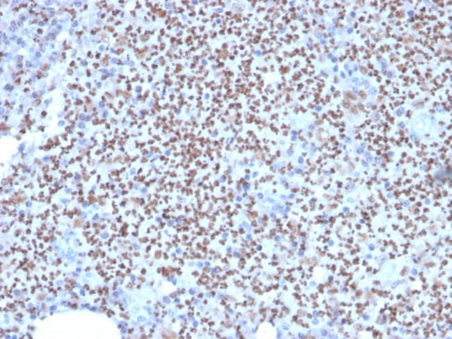 PU.1 (SPI-1) Antibody in Immunohistochemistry (Paraffin) (IHC (P))