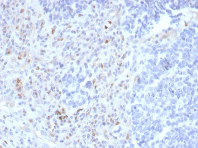 PU.1 (SPI-1) (B-Cell Marker) Antibody in Immunohistochemistry (Paraffin) (IHC (P))