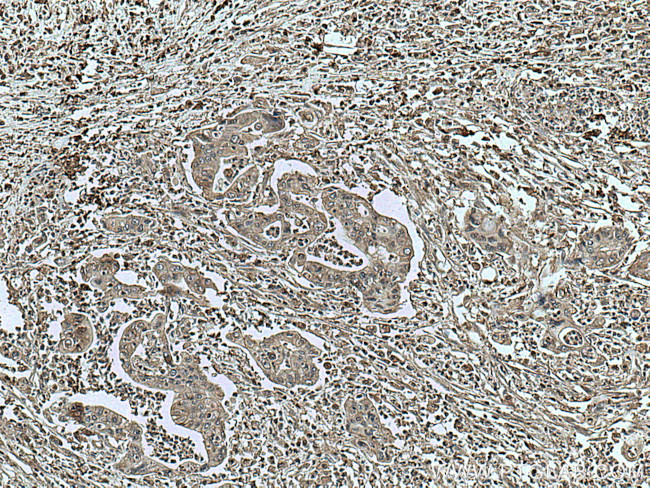 GRB2 Antibody in Immunohistochemistry (Paraffin) (IHC (P))