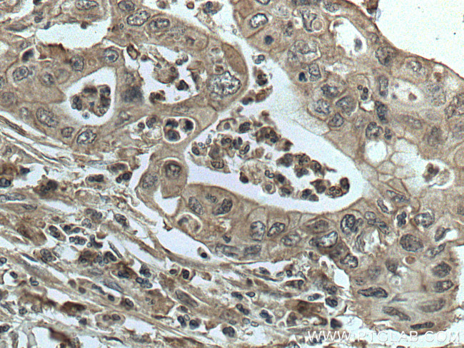 GRB2 Antibody in Immunohistochemistry (Paraffin) (IHC (P))