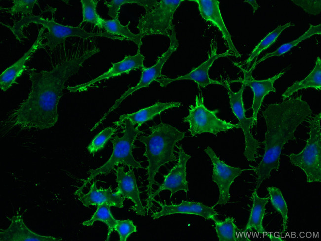 CD98/SLC3A2 Antibody in Immunocytochemistry (ICC/IF)