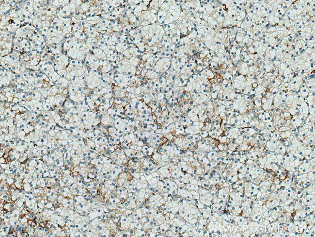 CD98/SLC3A2 Antibody in Immunohistochemistry (Paraffin) (IHC (P))