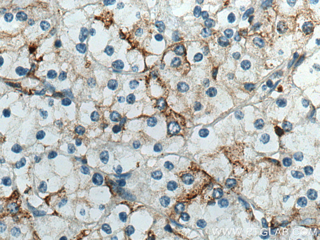 CD98/SLC3A2 Antibody in Immunohistochemistry (Paraffin) (IHC (P))