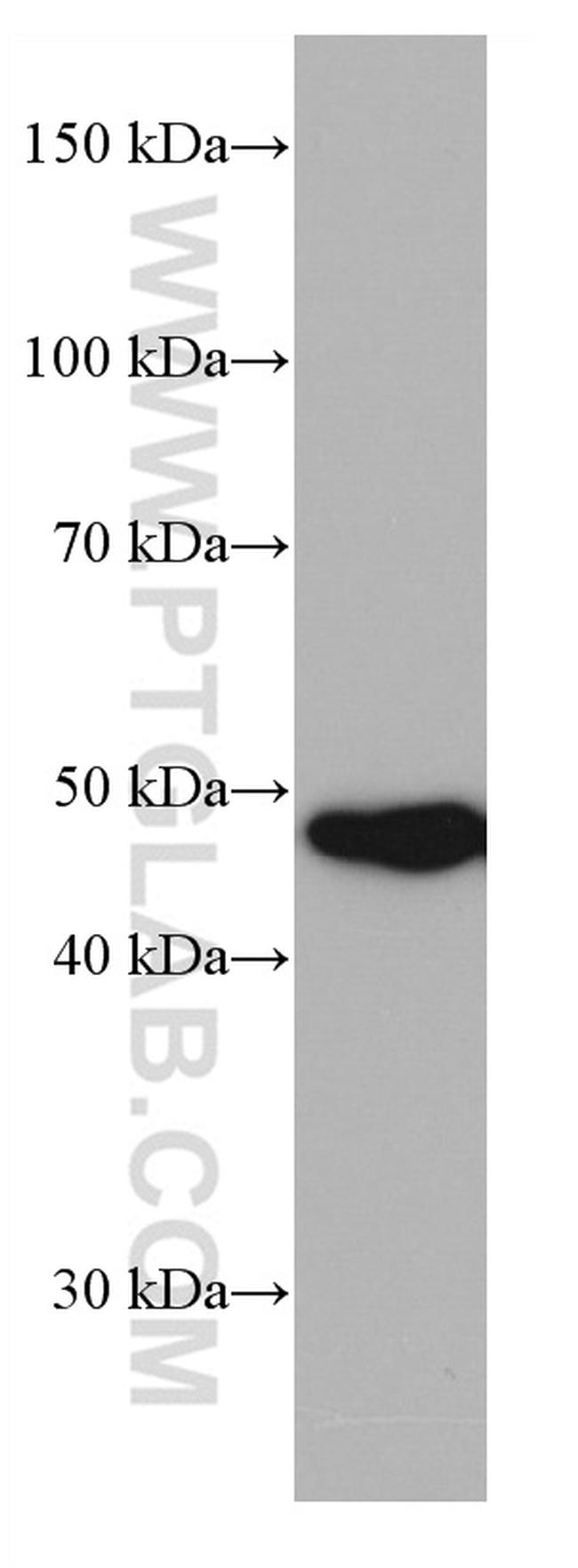 PRMT2 Antibody in Western Blot (WB)