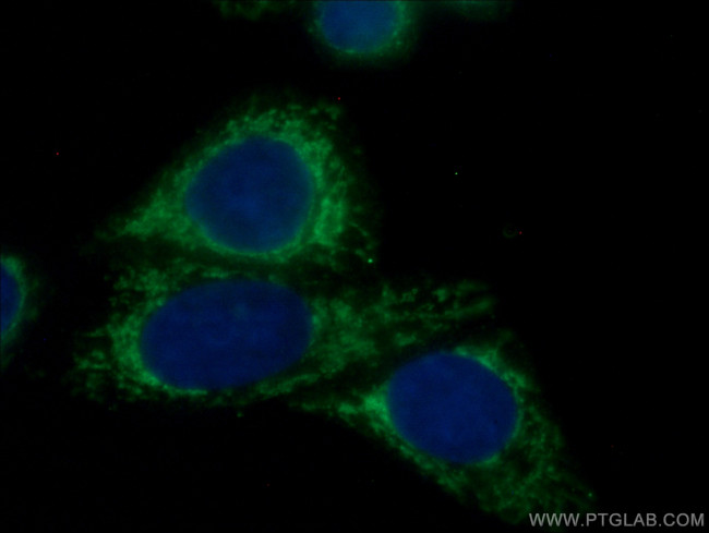 mTOR Antibody in Immunocytochemistry (ICC/IF)