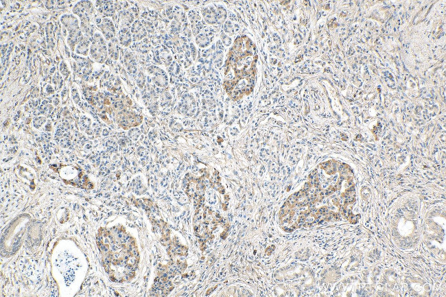 GLUT2 Antibody in Immunohistochemistry (Paraffin) (IHC (P))