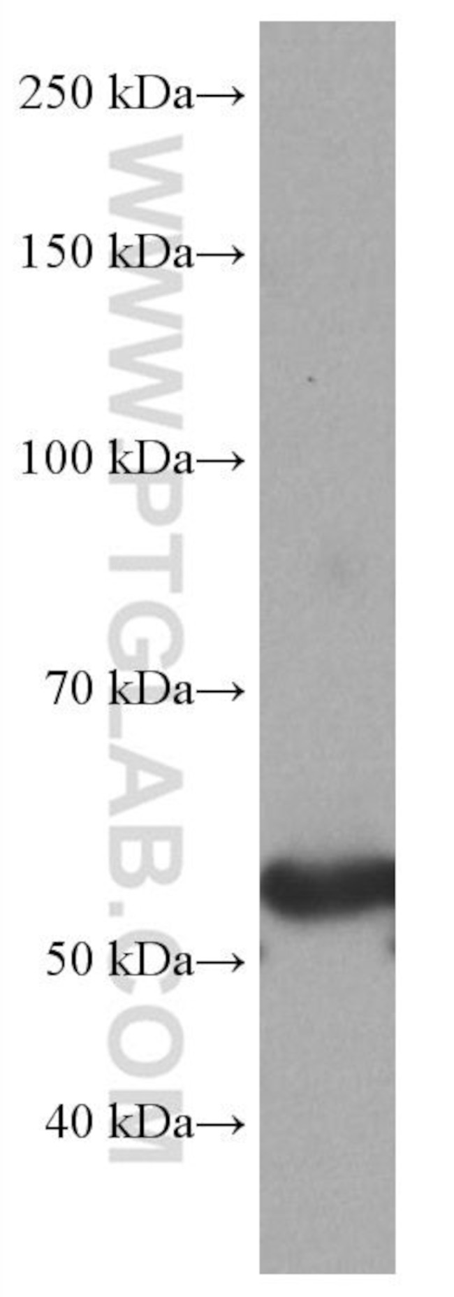 GLUT2 Antibody in Western Blot (WB)