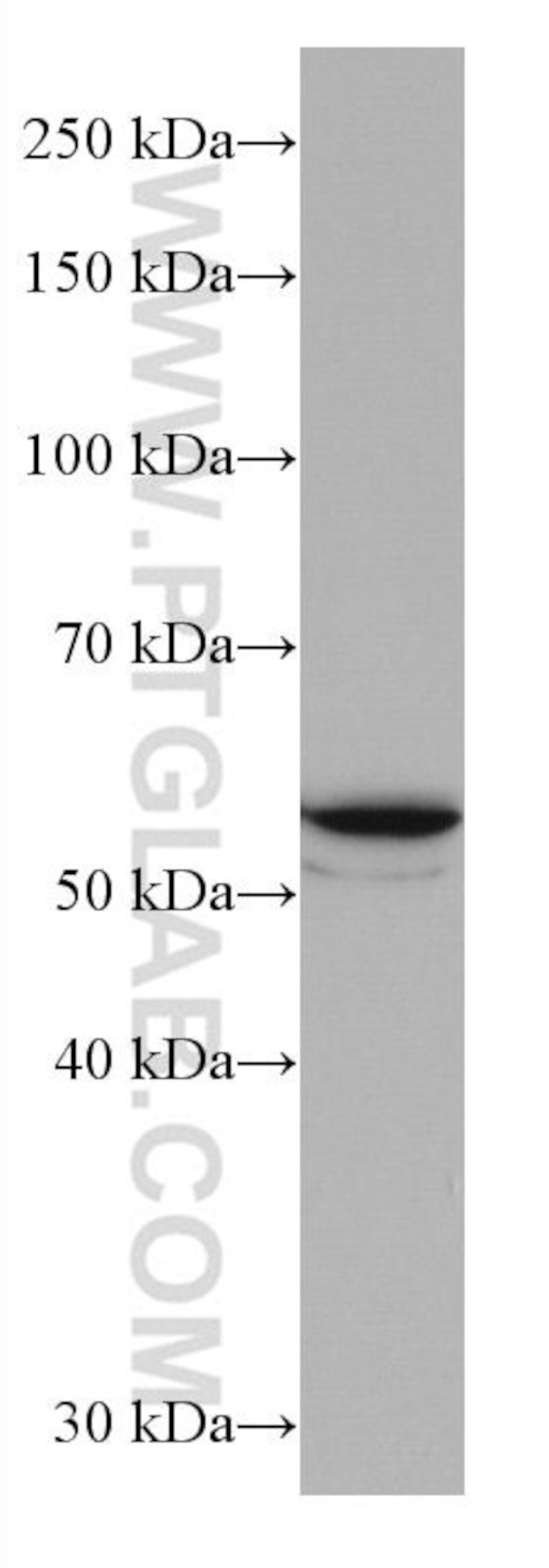 GLUT2 Antibody in Western Blot (WB)