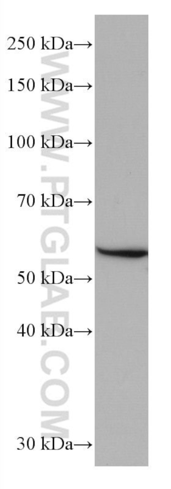 GLUT2 Antibody in Western Blot (WB)
